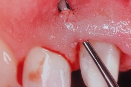 How to handle peri- and postoperative complications 